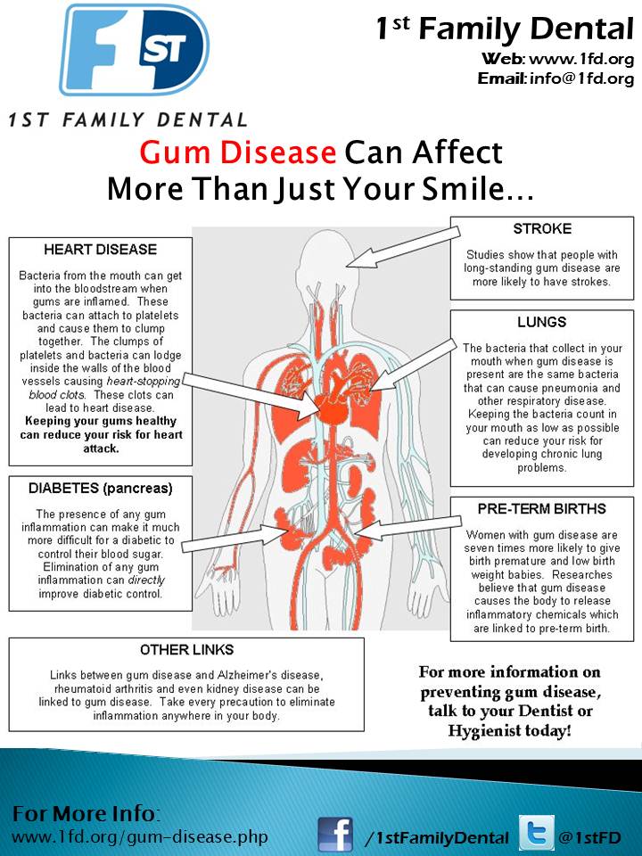 Gum Disease & Whole-Body Health Gum Disease & Whole-Body Health